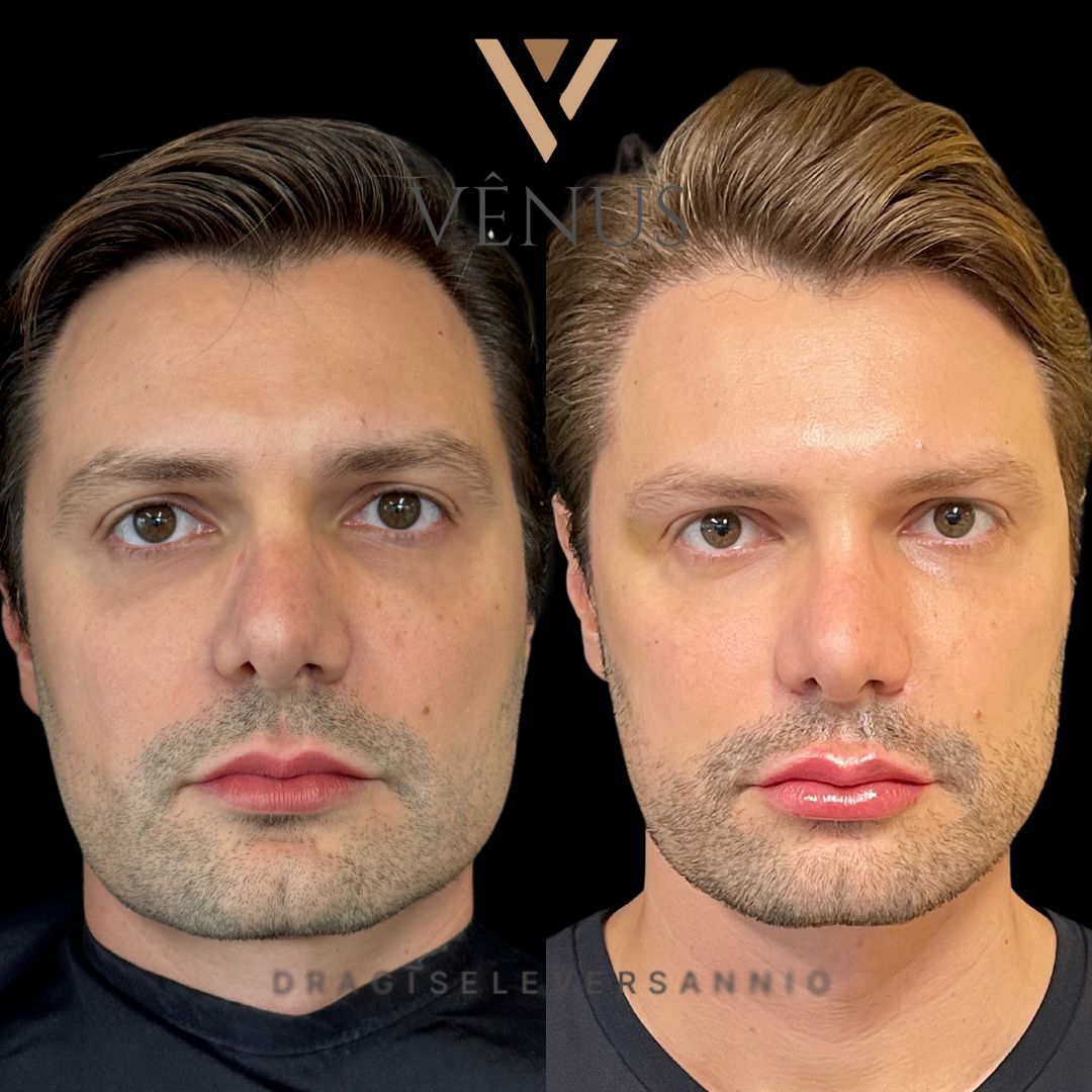 Gisele De Carvalho Versannio-21