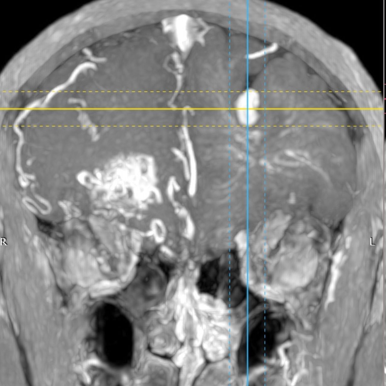 David Tafur Muñoz-1327