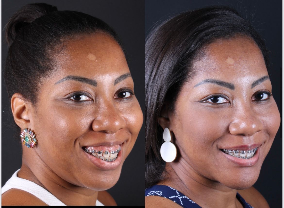 Frederico Carnevale-5