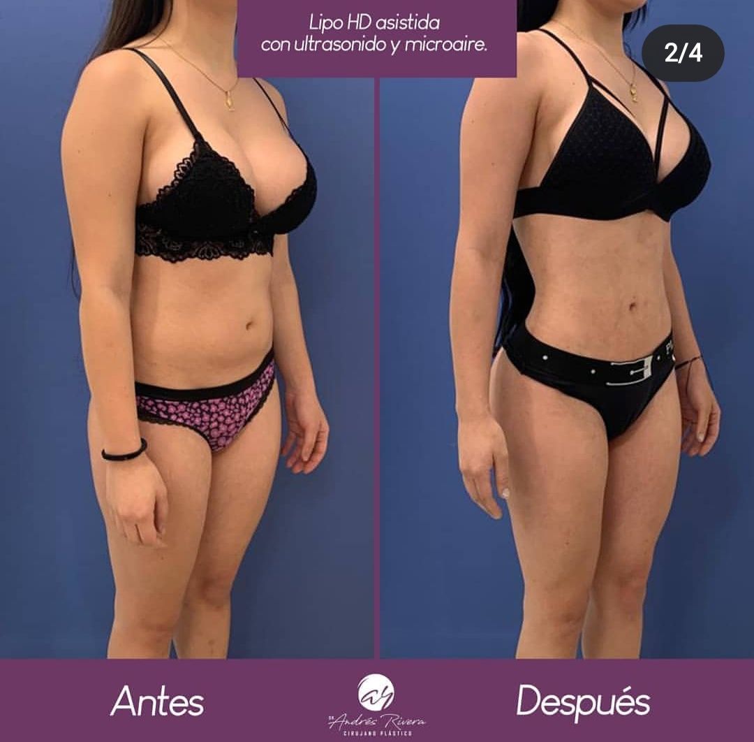 Andrés Rivera López-26