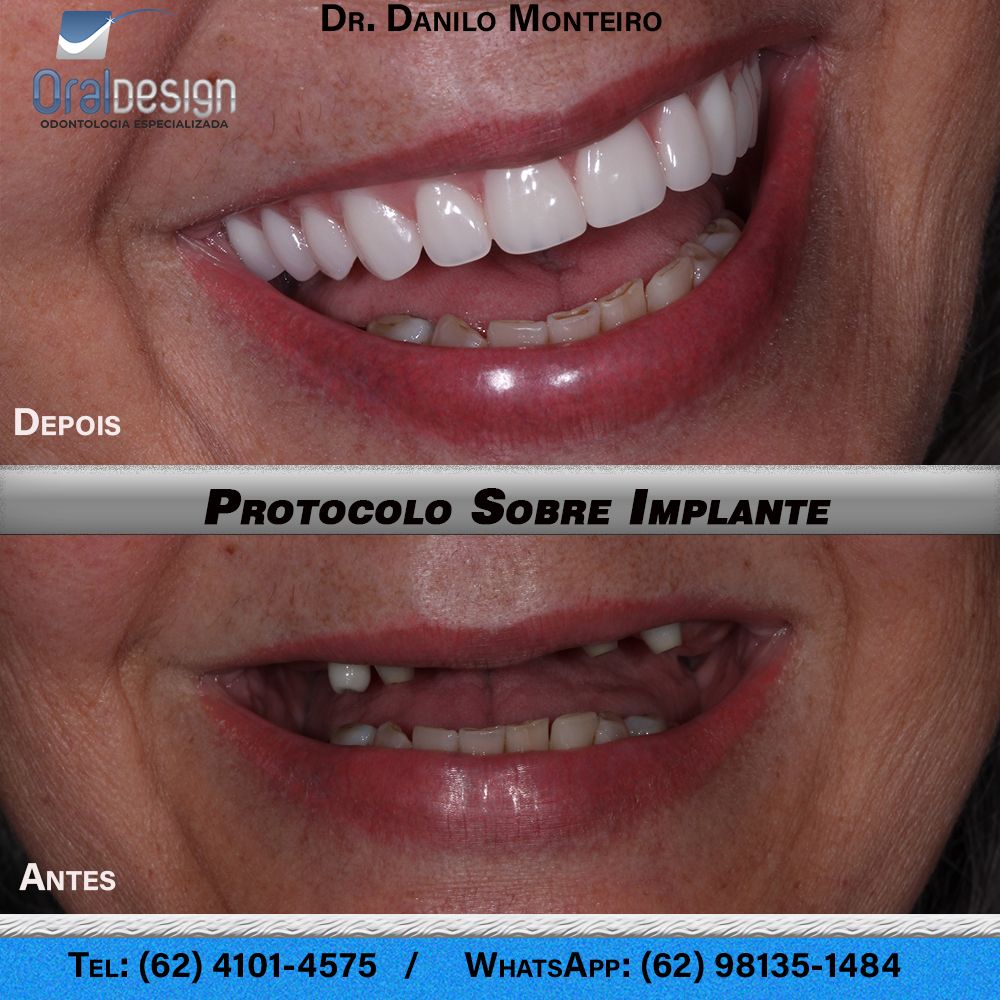 Danilo Monteiro Rezende Pereira-17