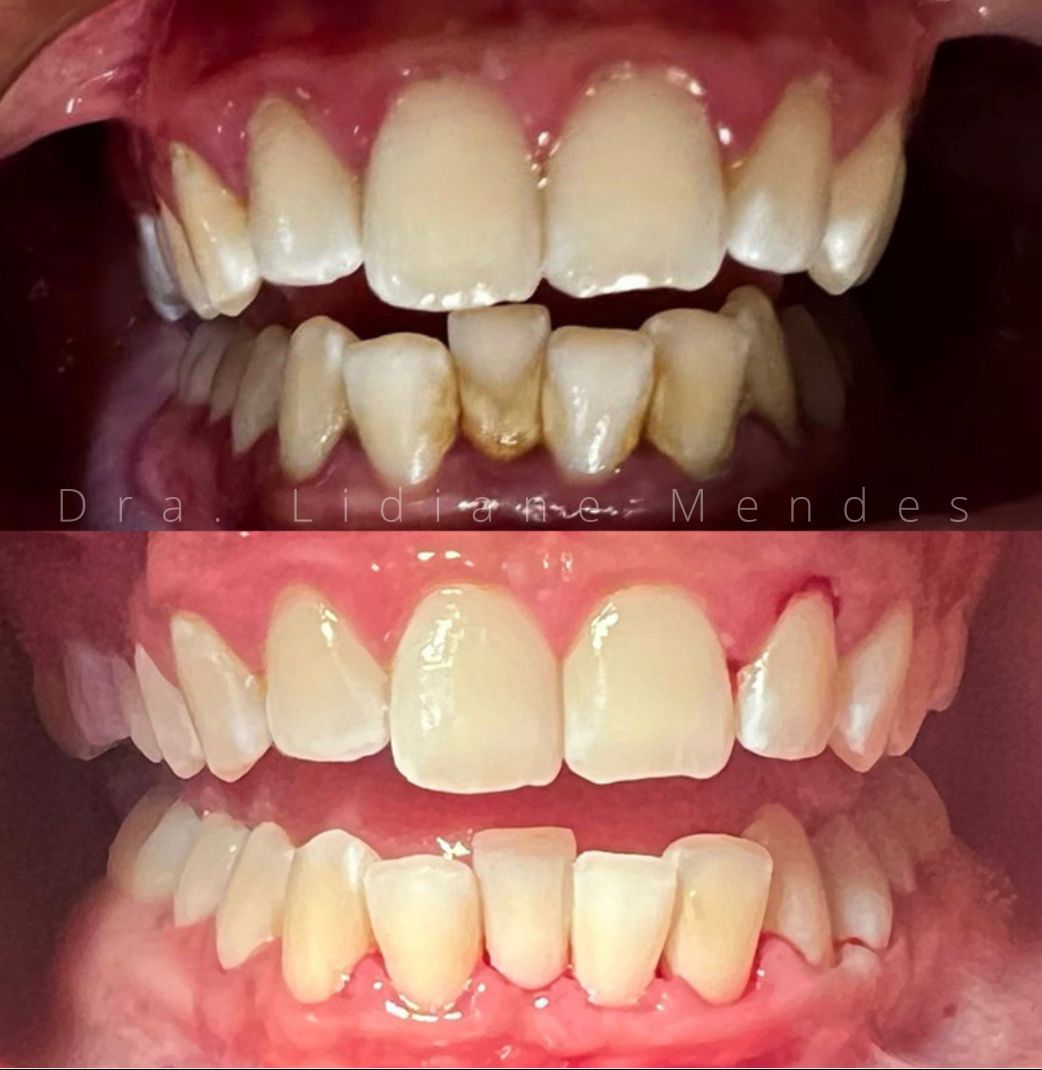 Lidiane Morais Mendes-14