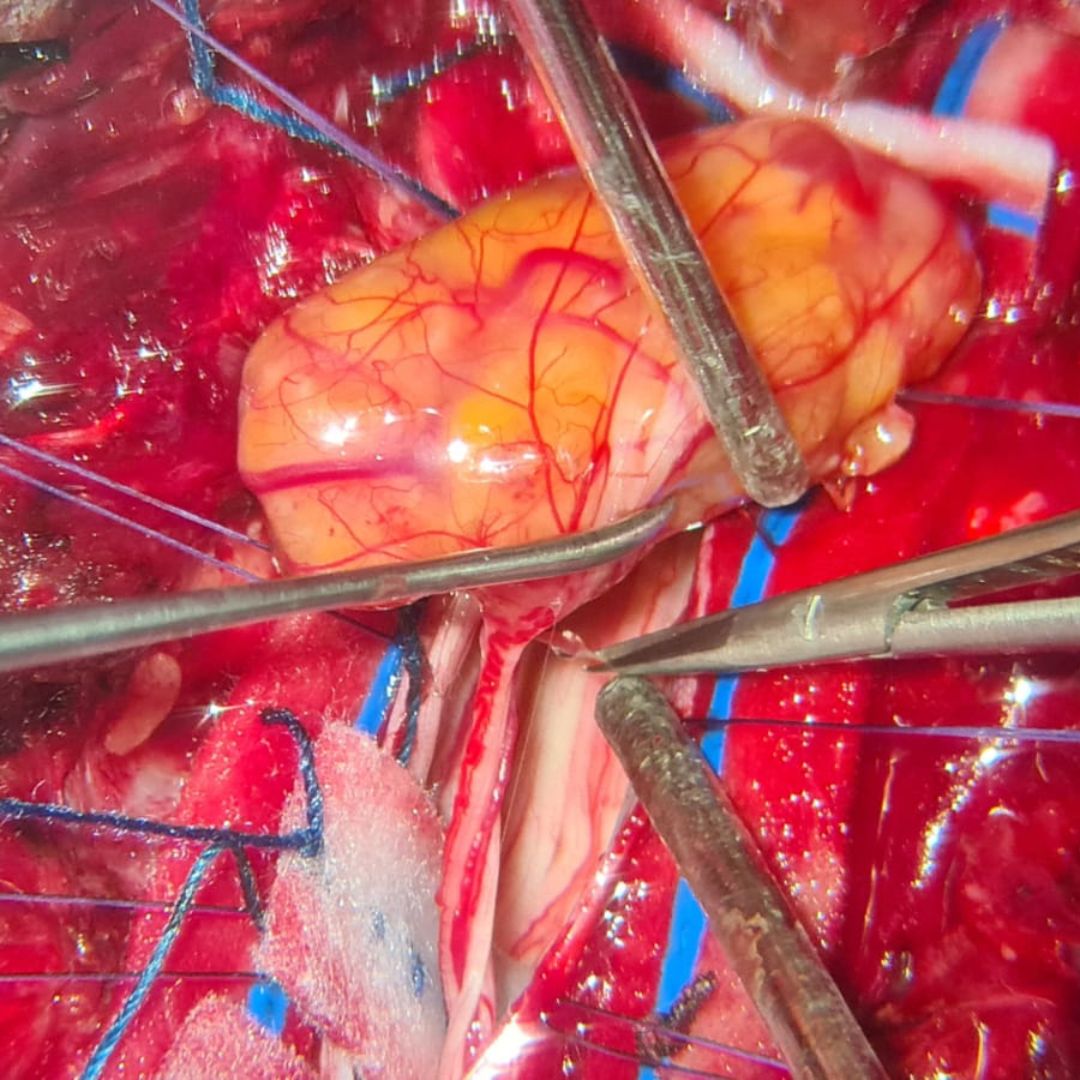 David Tafur Muñoz-2101