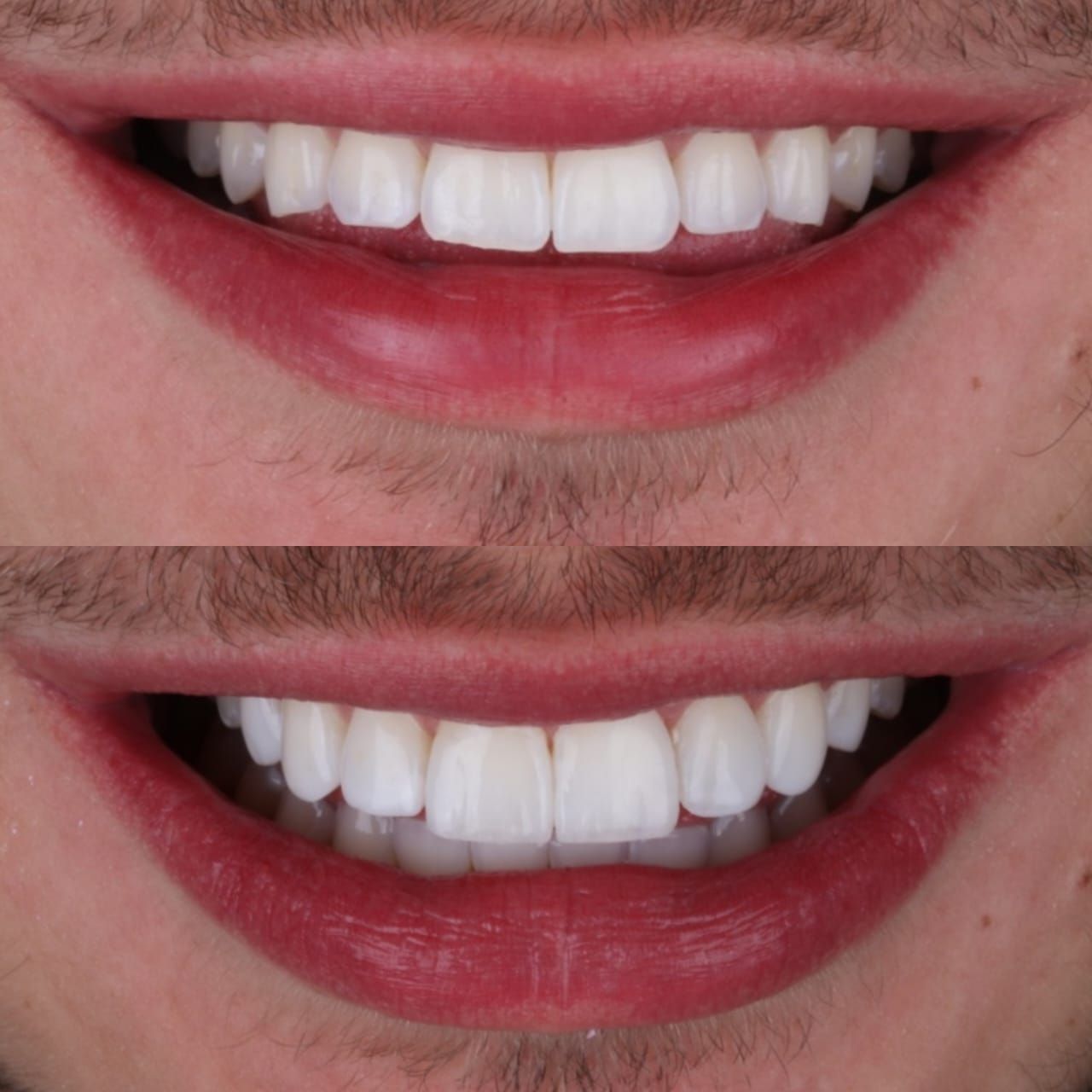 Sharon Andrea Waldo Nicholls-0