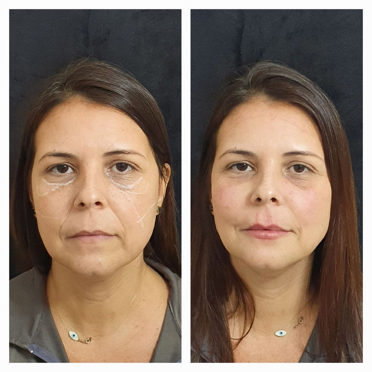 Otacilio Passarelli Ribeiro-11