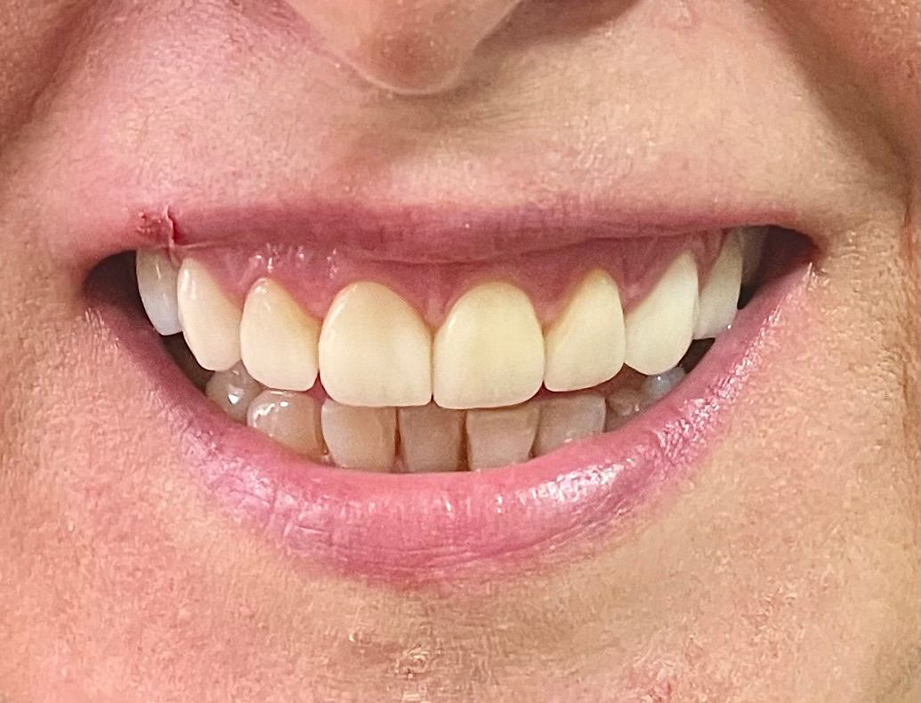 Luciano Varas Salinas-40