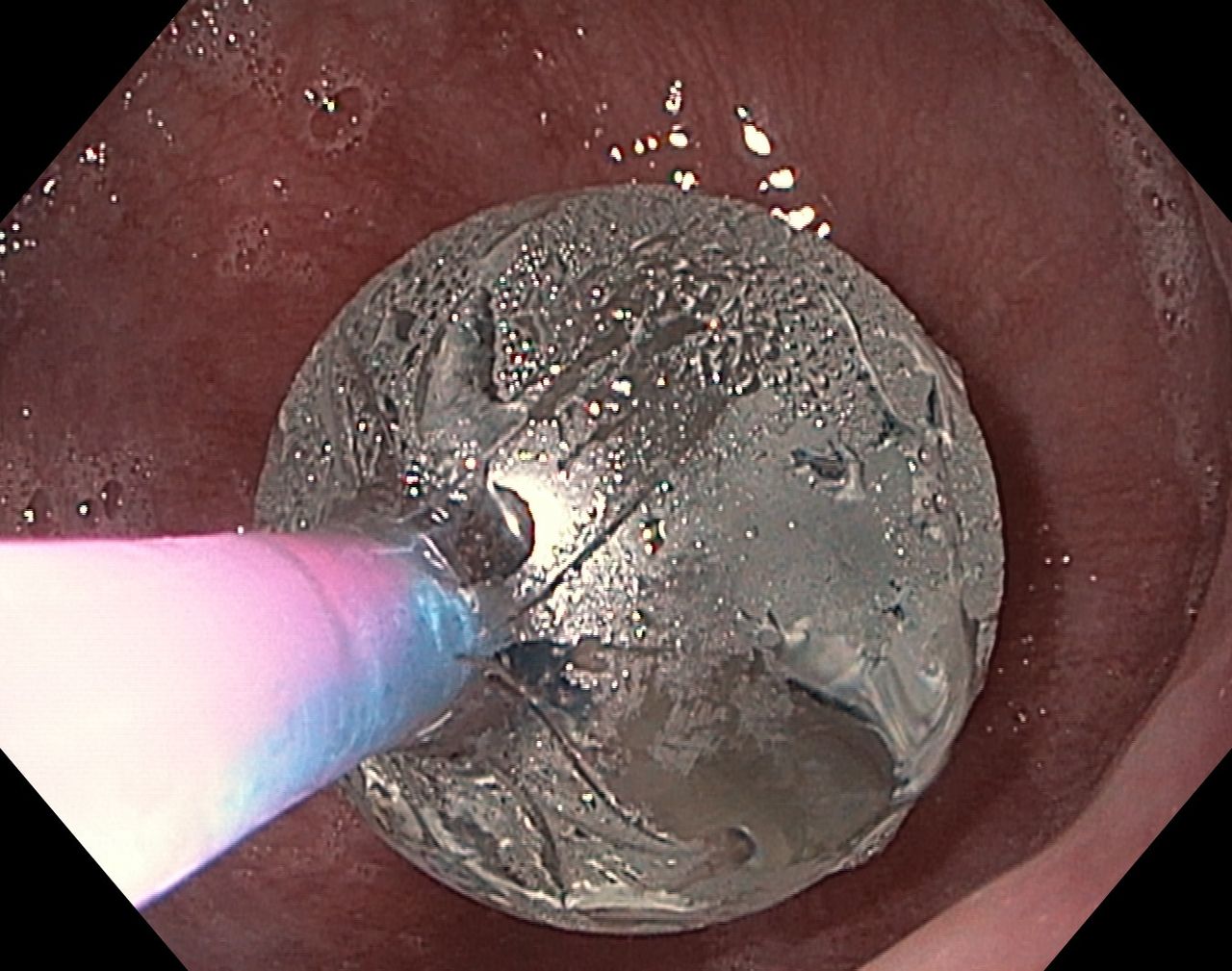 Hernán Del Carpio Zeballos-5