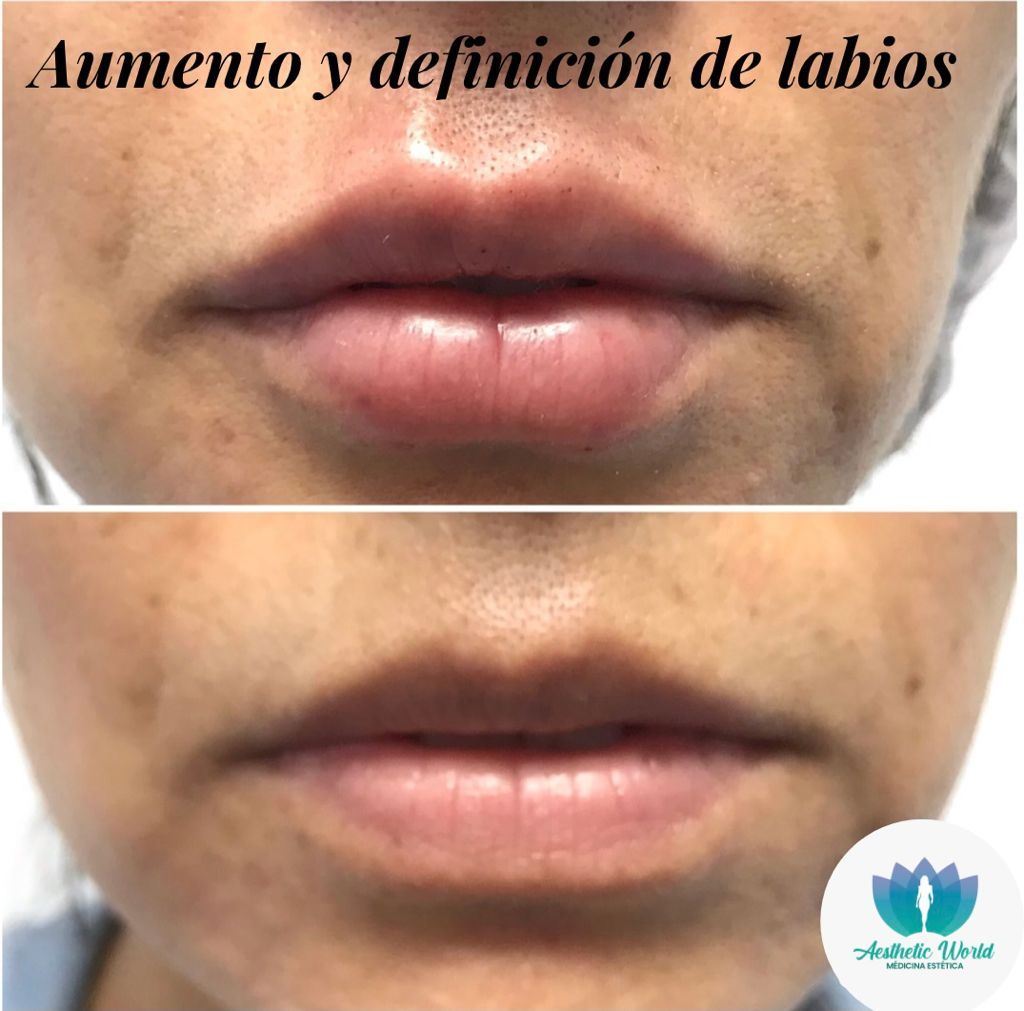 Jhonatan Oyola Farfán-10