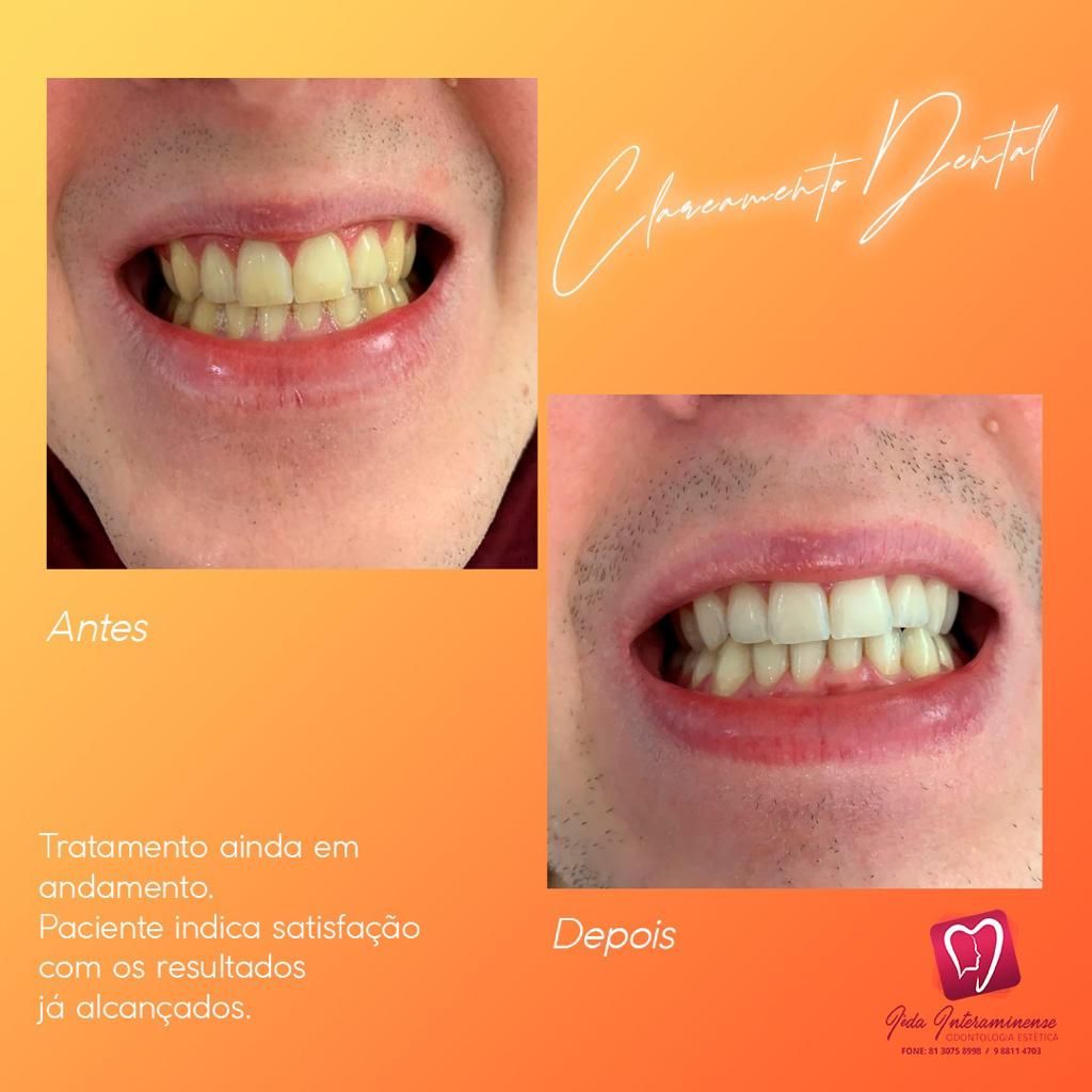 Iêda Interaminense-16