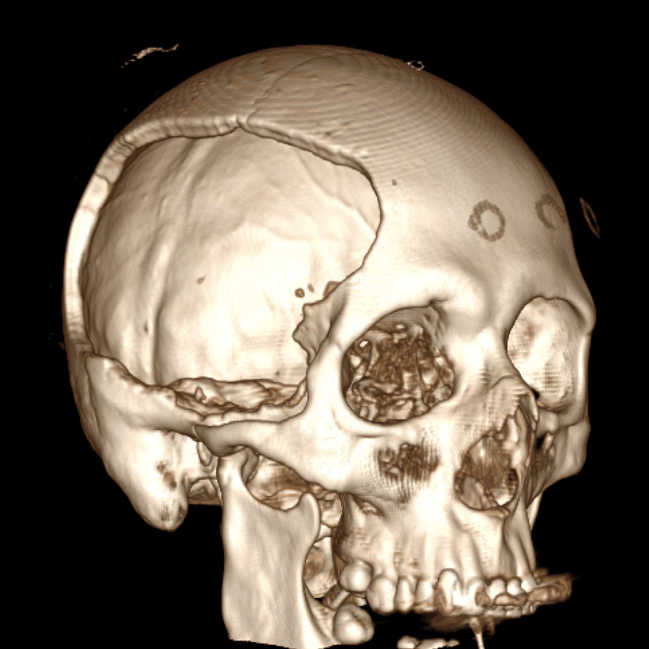 David Tafur Muñoz-2355