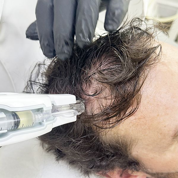 Humberto Antônio Ponzio-1