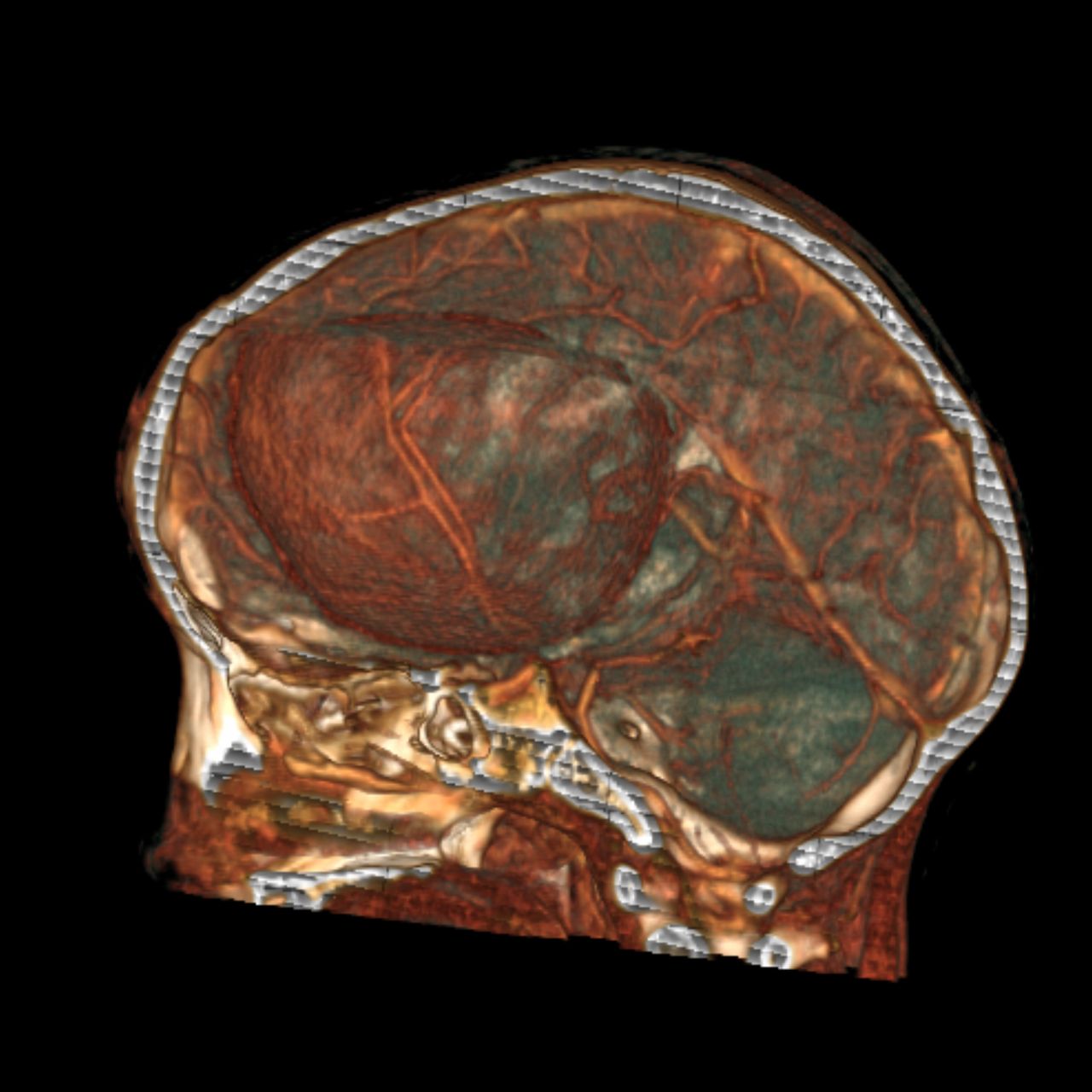 David Tafur Muñoz-1263