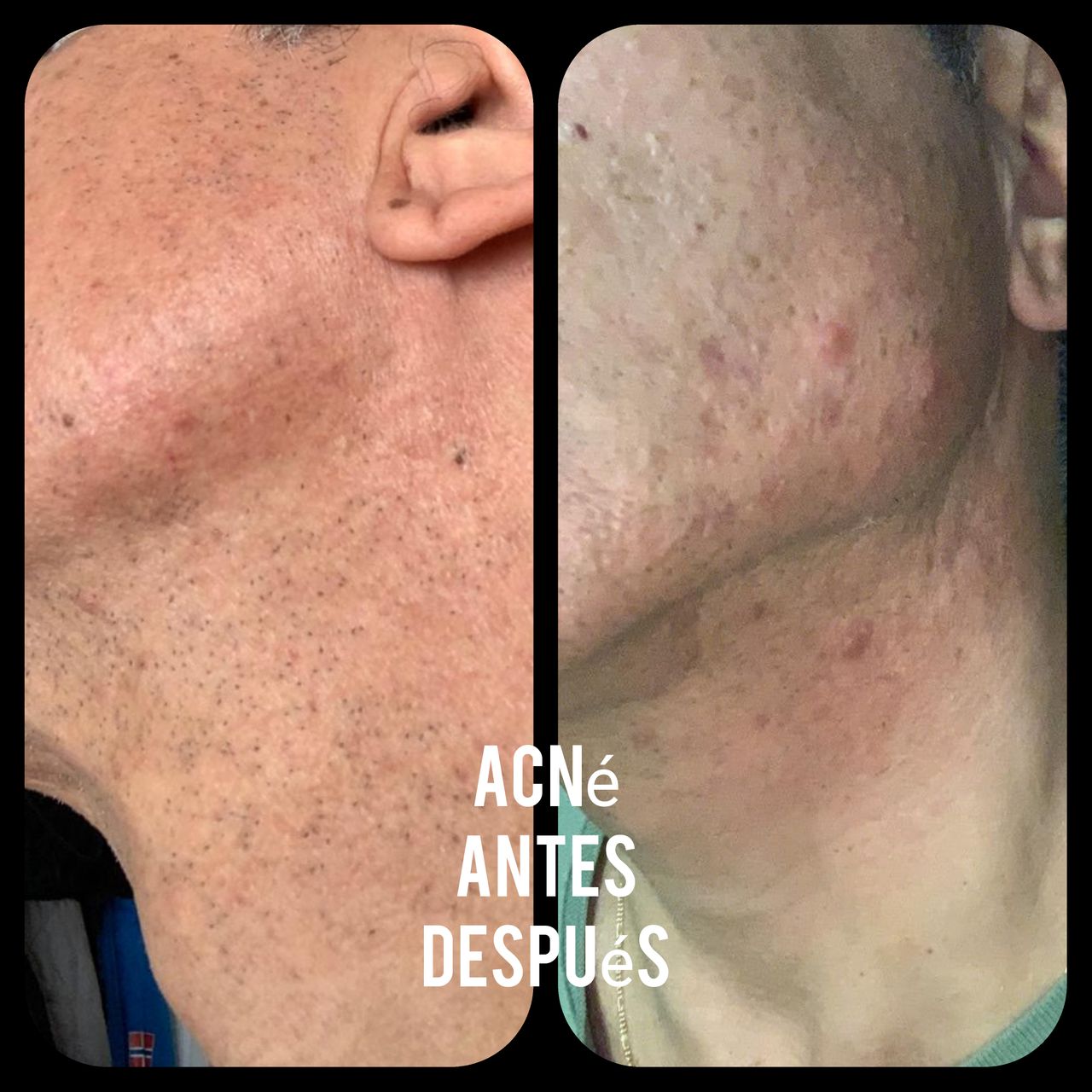 Alejandra Meijide-40