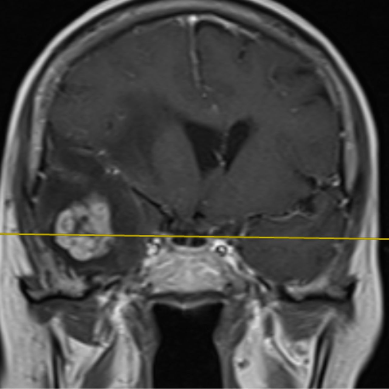 David Tafur Muñoz-1870