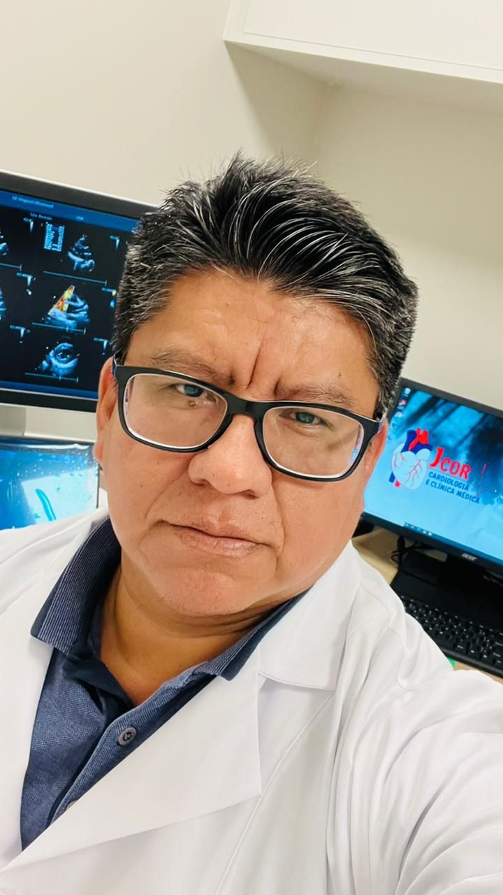 Juan De Dios Amachuy Alaca-0