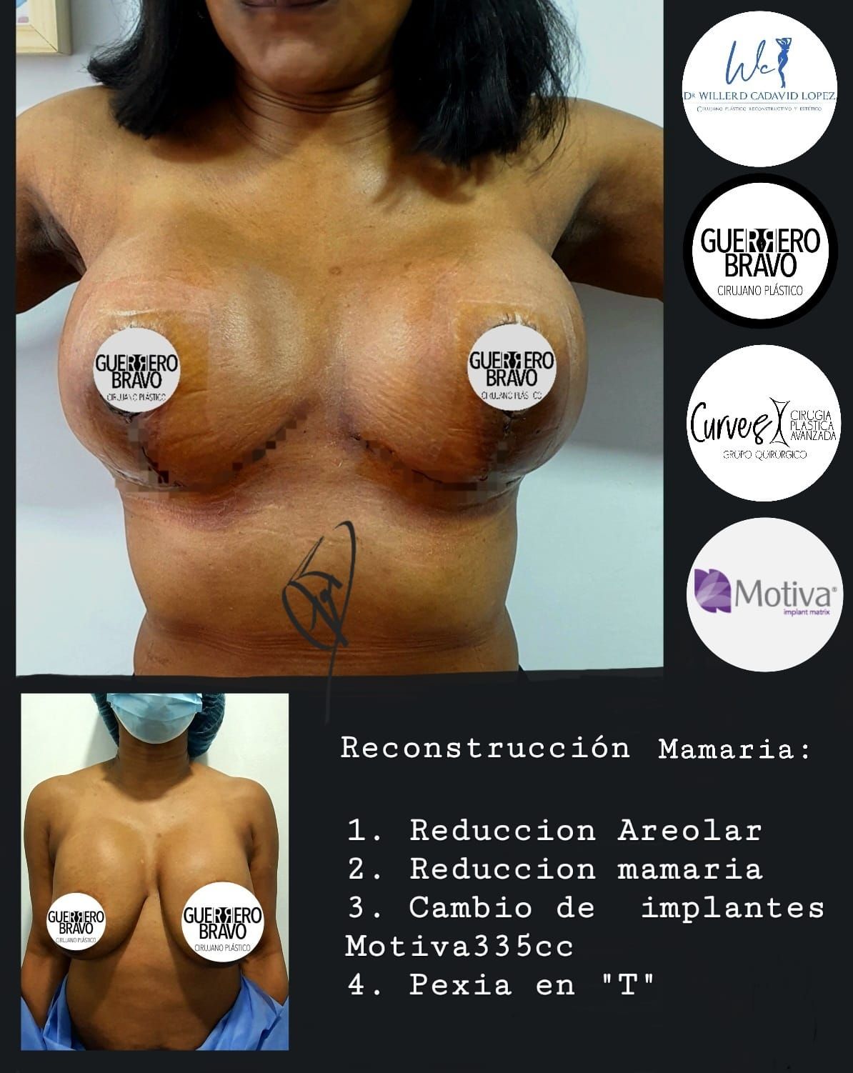 Camilo Guerrero Bravo-23