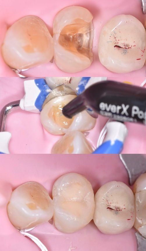 J. Felipe De Lapeyra R.-2