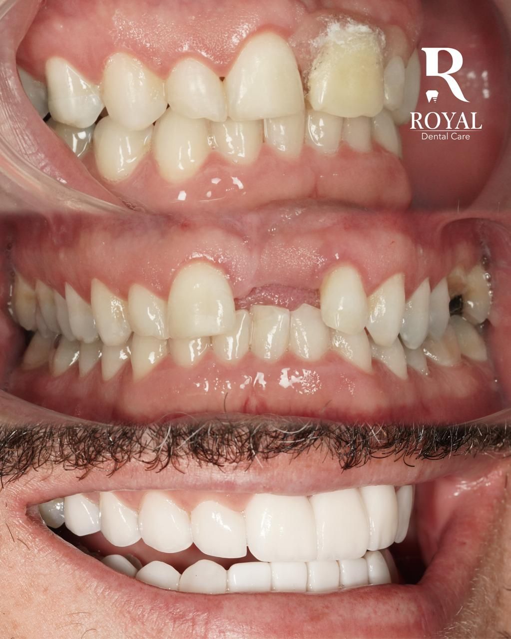 Esteban De Jesús Morelo Galvan-0