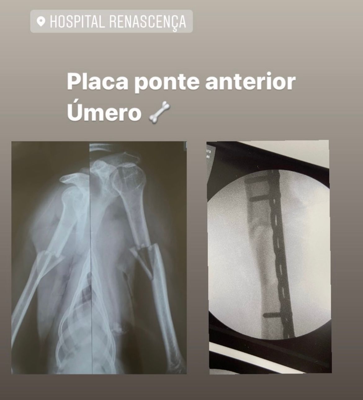 Fernando Gouvea-16