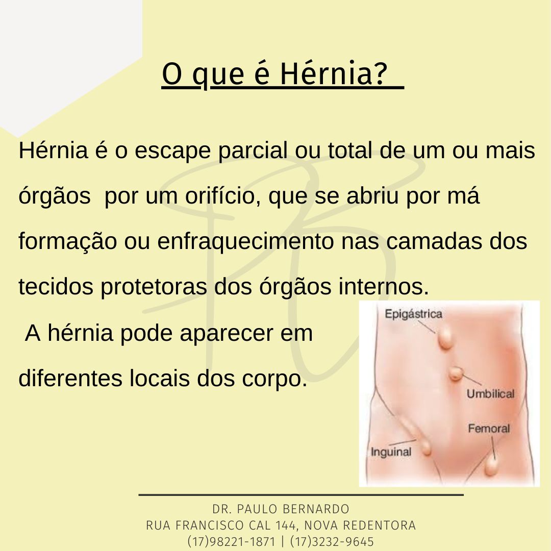 Paulo Leandro Alves Bernardo-3