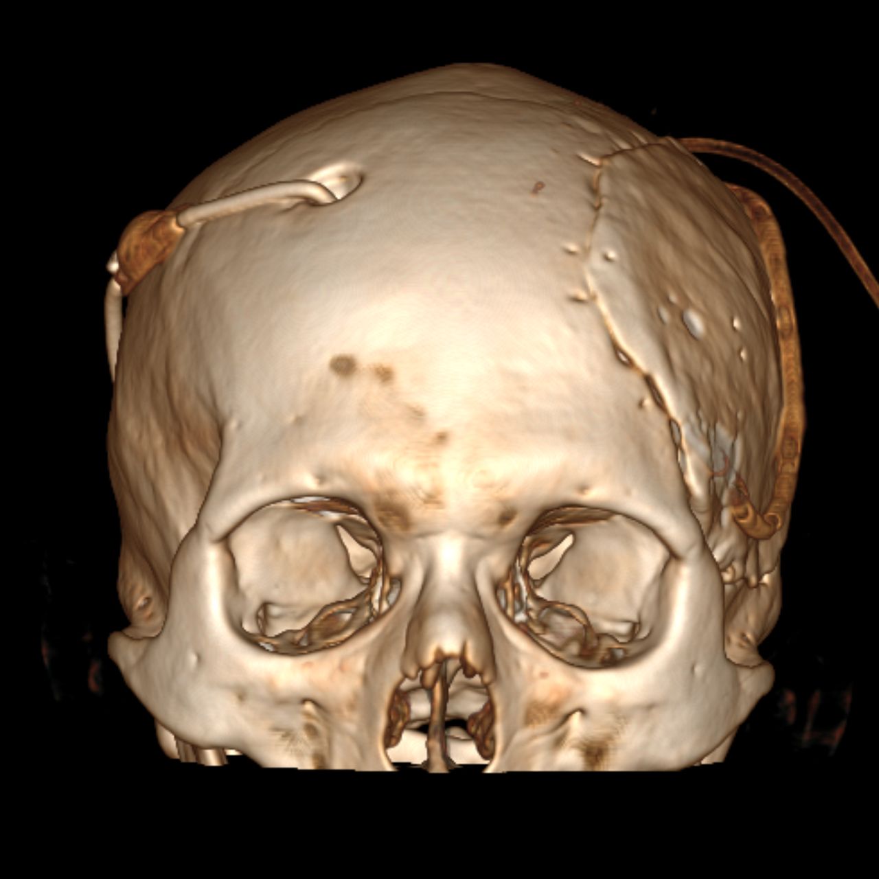 David Tafur Muñoz-1213