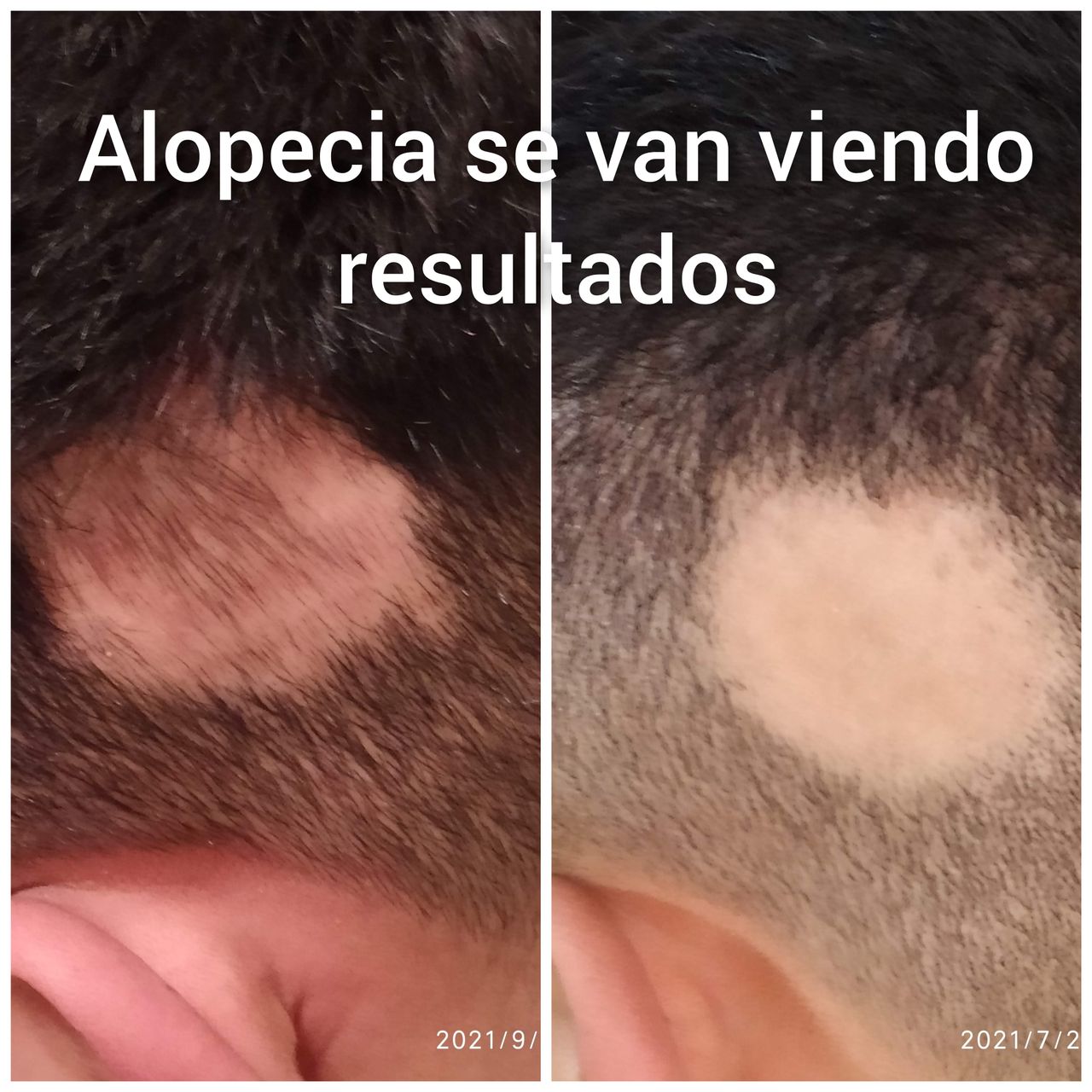 Alejandra Meijide-22