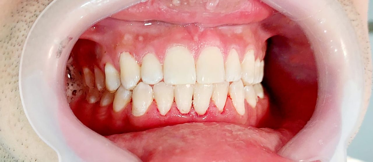 Nazinsky Rodriguez Arias-18