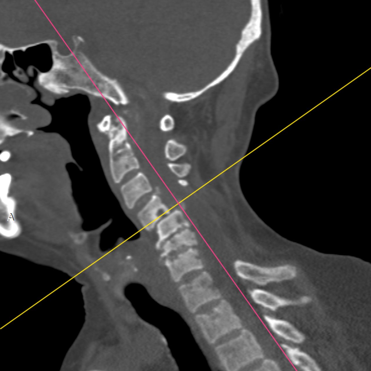 David Tafur Muñoz-1697