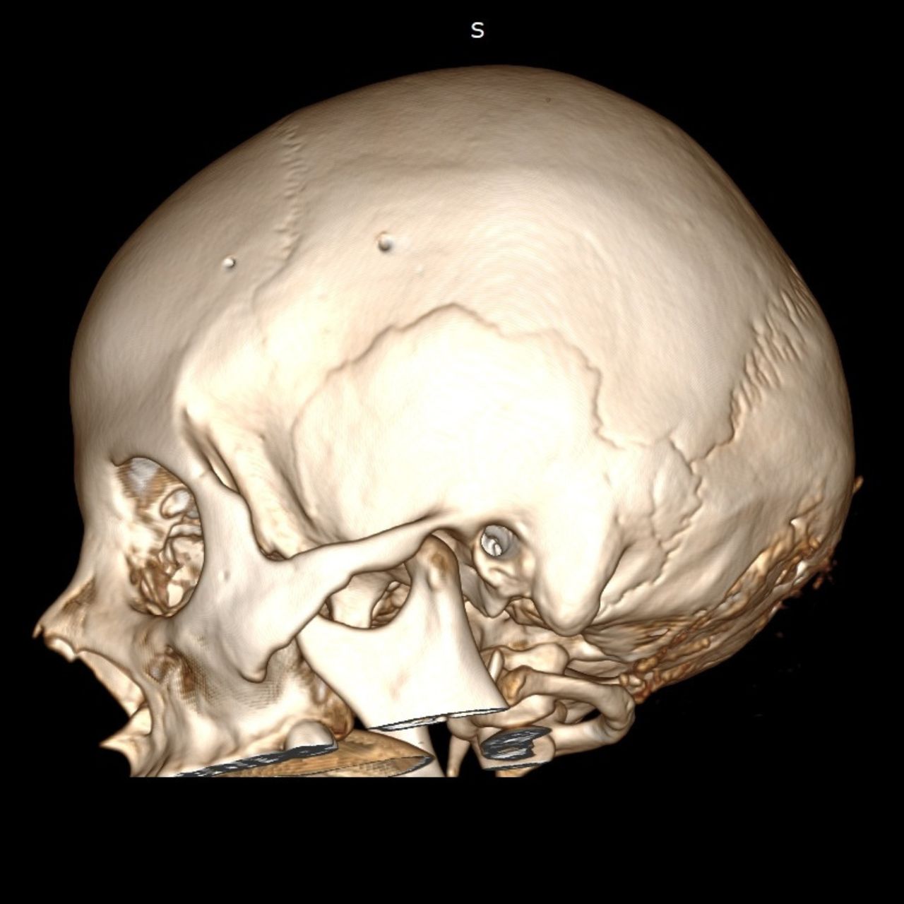 David Tafur Muñoz-1254