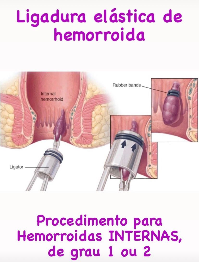 Andrea Pecci Rabello-9