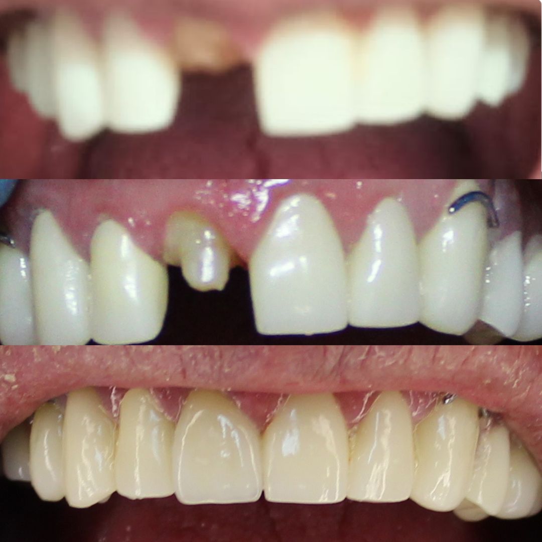 Nicole Poblete Quezada-3