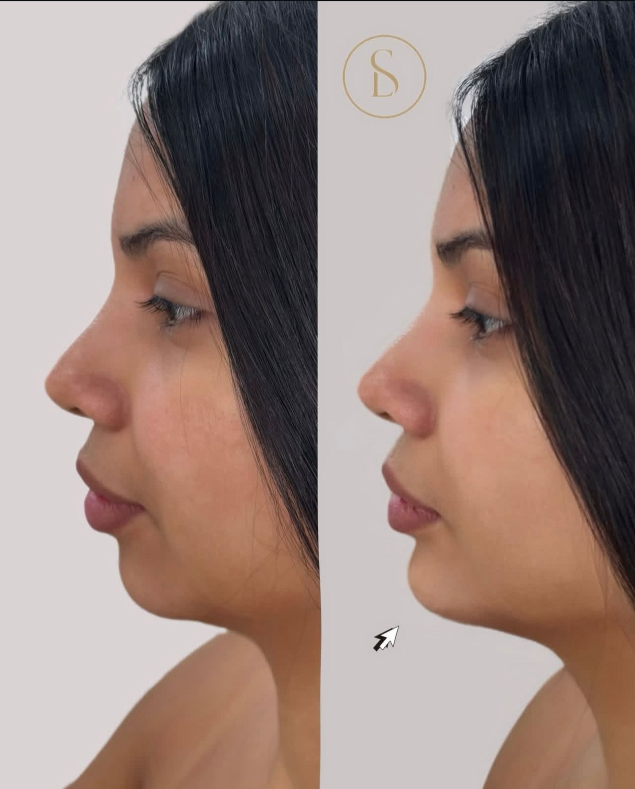 Liliana Spitaletta-0