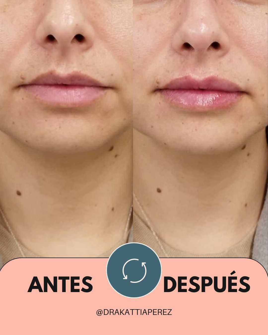 Kattia Peréz Vaca-5