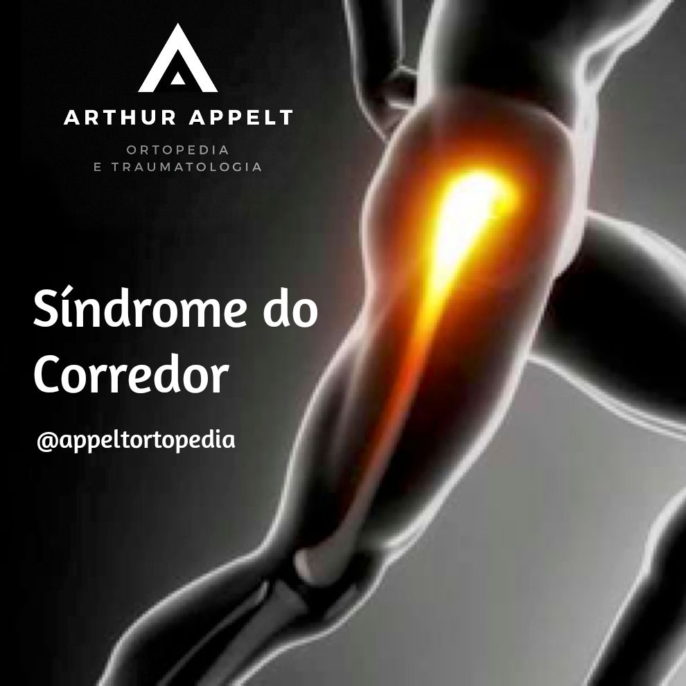 Arthur Lanna Appelt-11