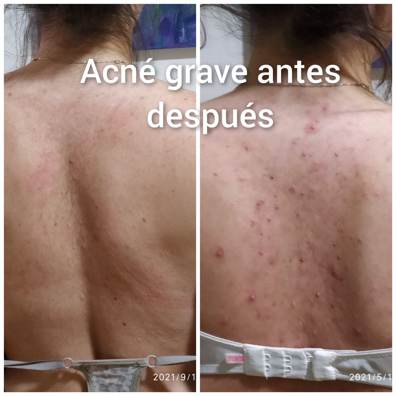 Alejandra Meijide-26