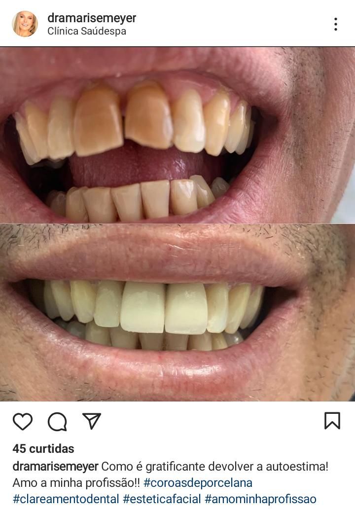 Marise Meyer Jamur-3