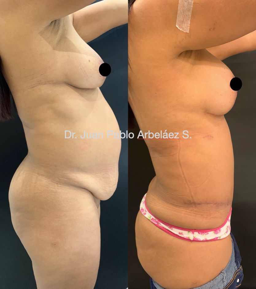 Juan Pablo Arbeláez Sierra-19