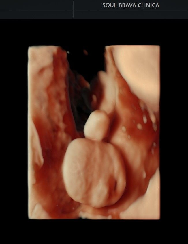 Charles Schwantz De Lima-26