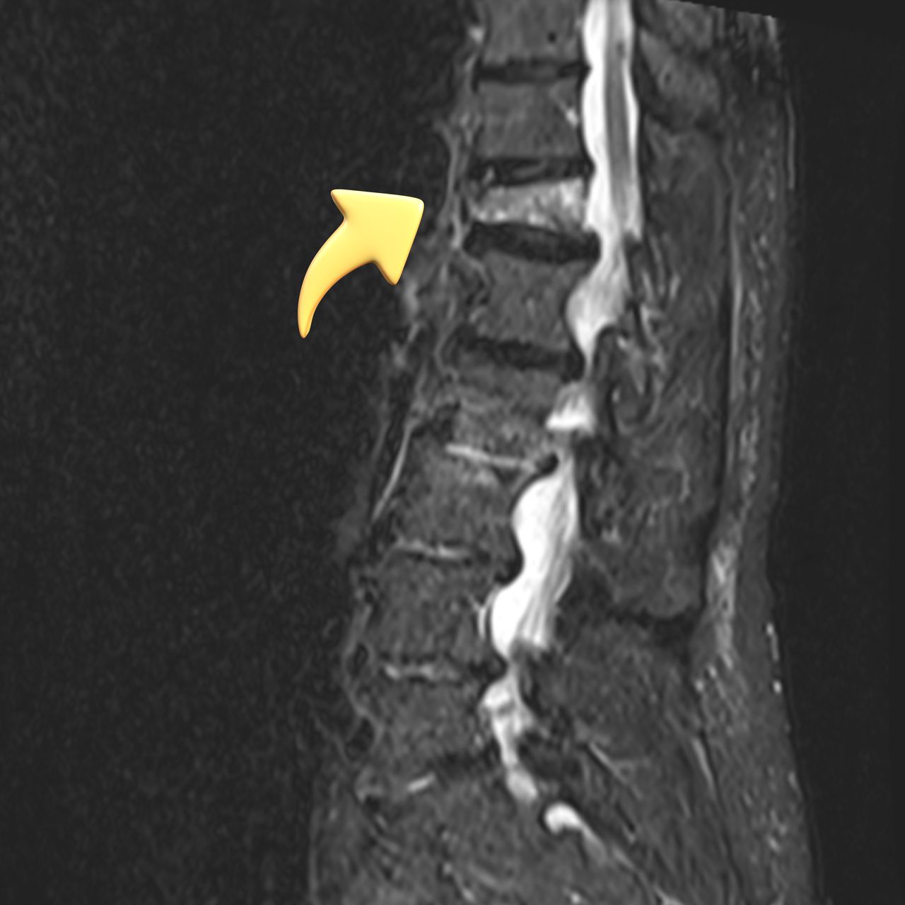 David Tafur Muñoz-1698