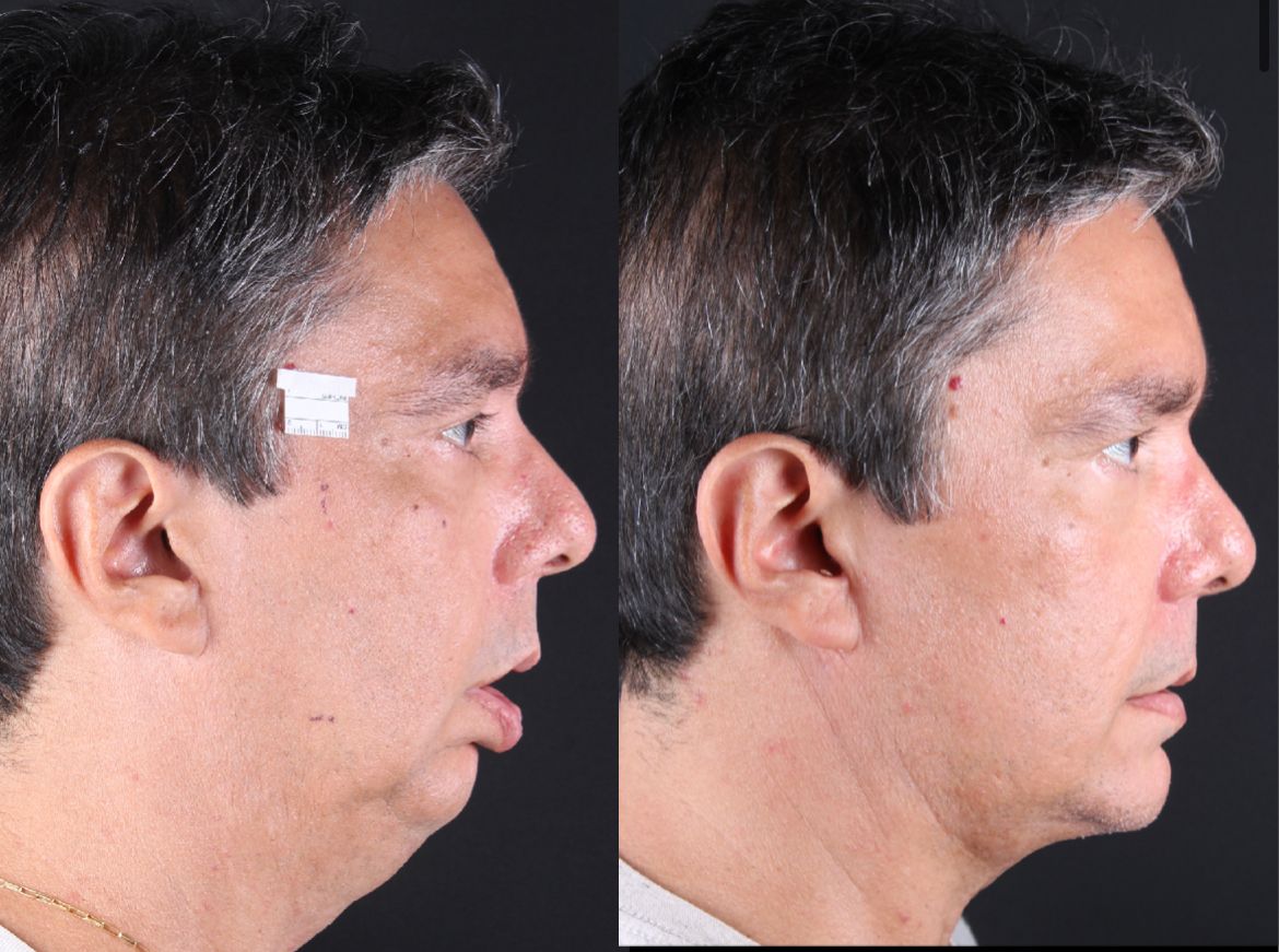 Frederico Carnevale-8