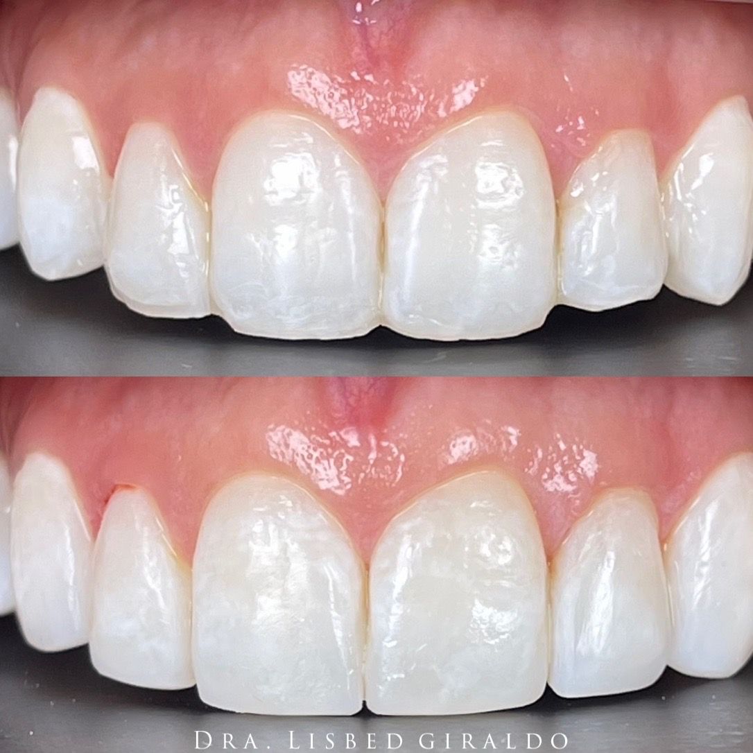 Lisbed Giraldo Olarte-14