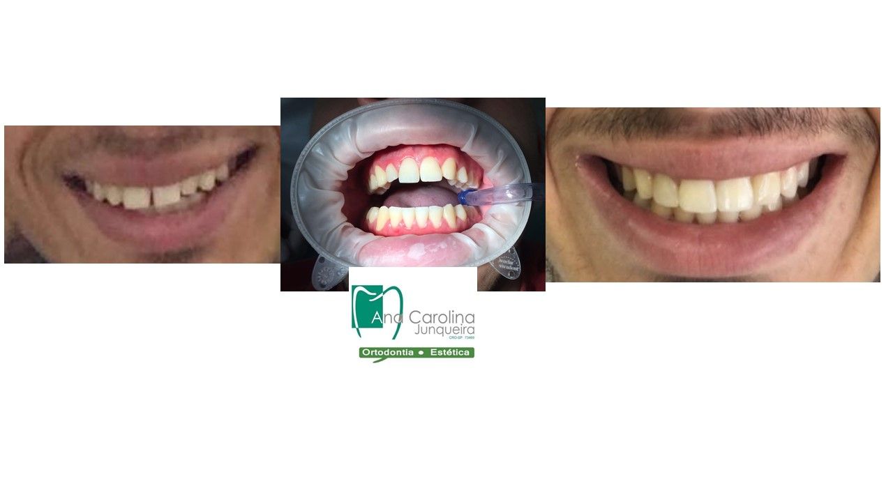 Ana Carolina Junqueira Defina-11