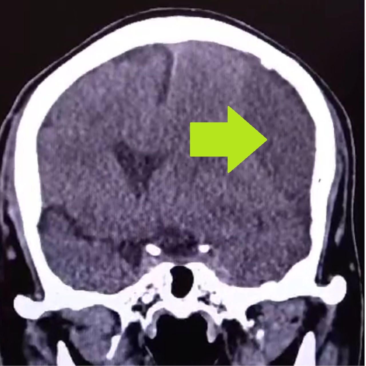 David Tafur Muñoz-1174