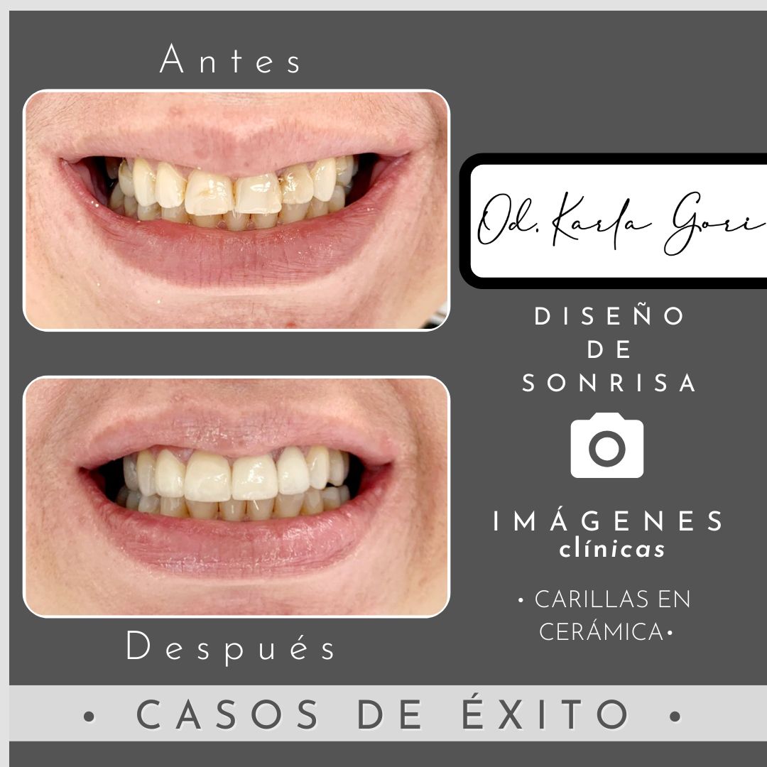 Karla Patricia Gori Romero-14