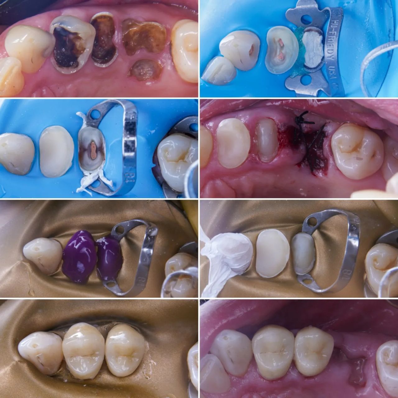 Javier Garrido Tirado-22