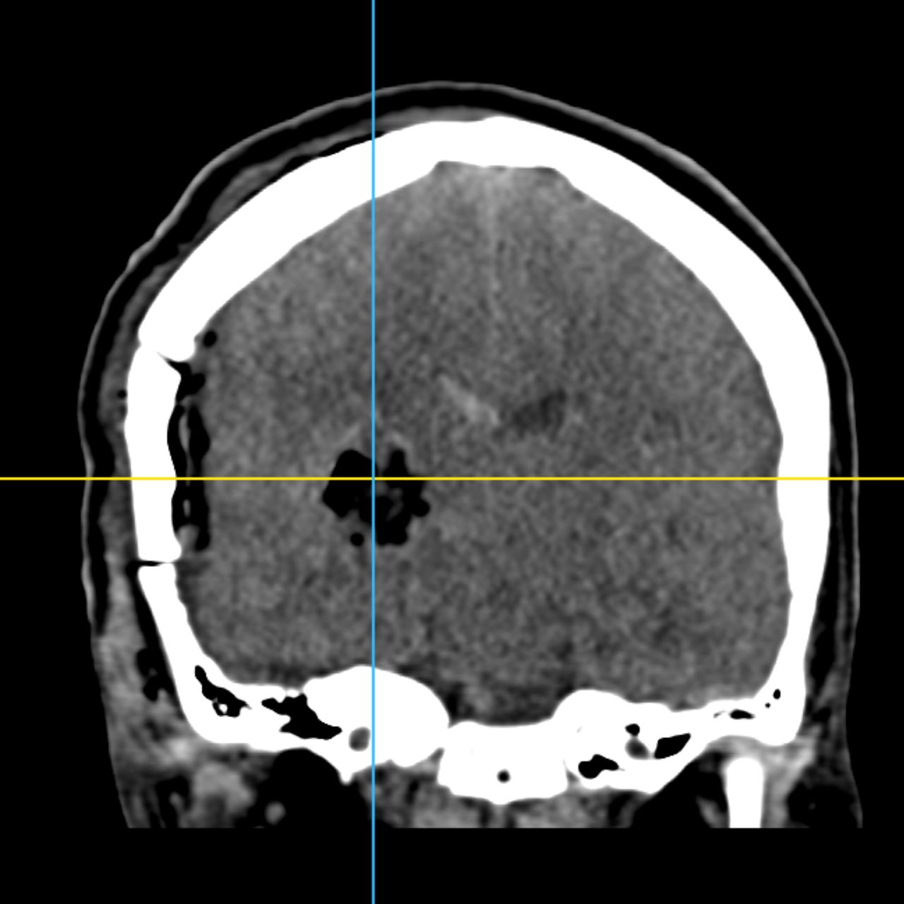 David Tafur Muñoz-2071