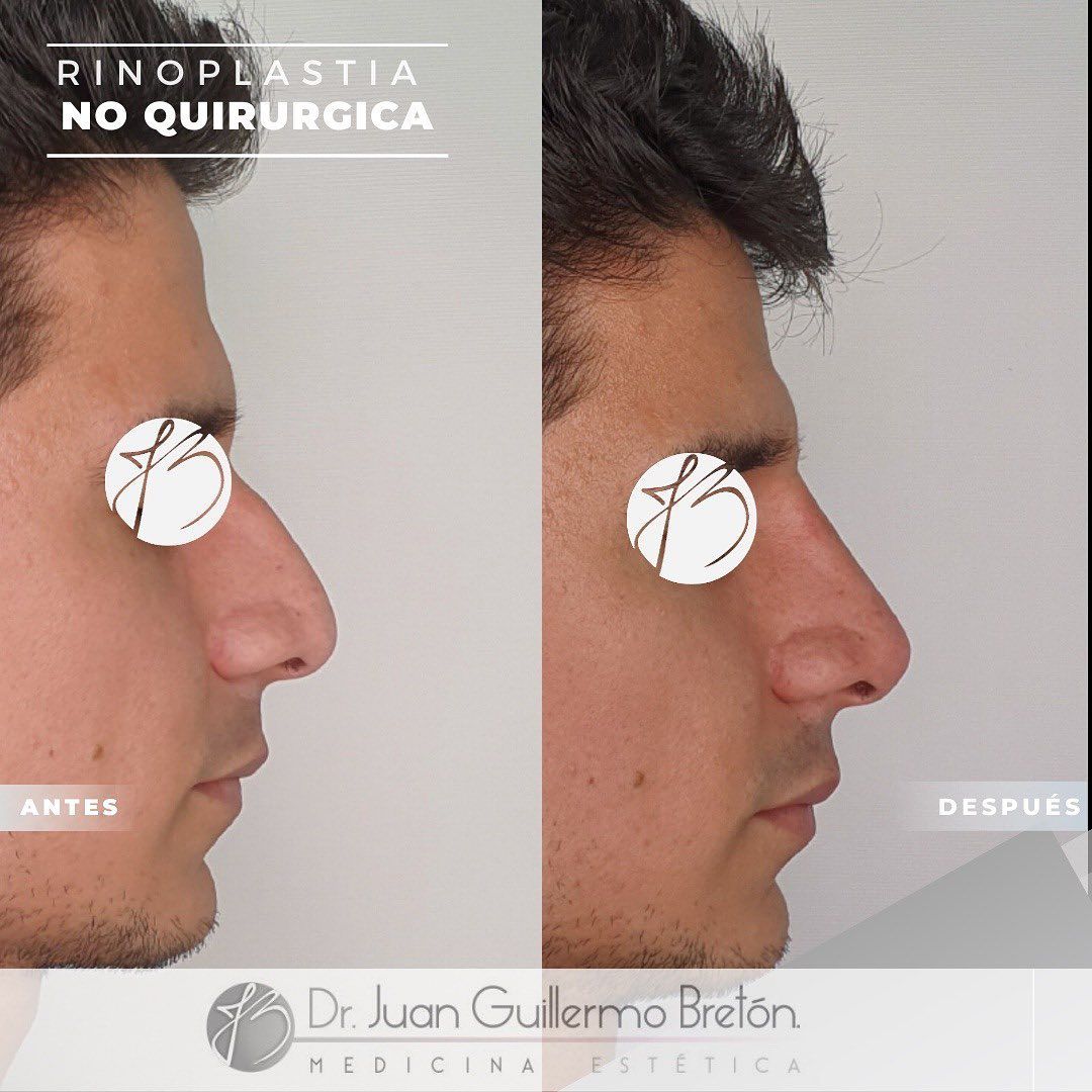 Juan Guillermo Bretón Franco-5