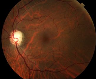 Lucca Ortolan Hansen-6