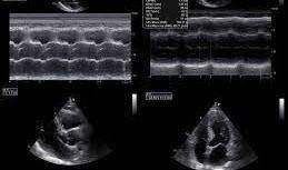 Herlinda María Ramirez Jiménez-3