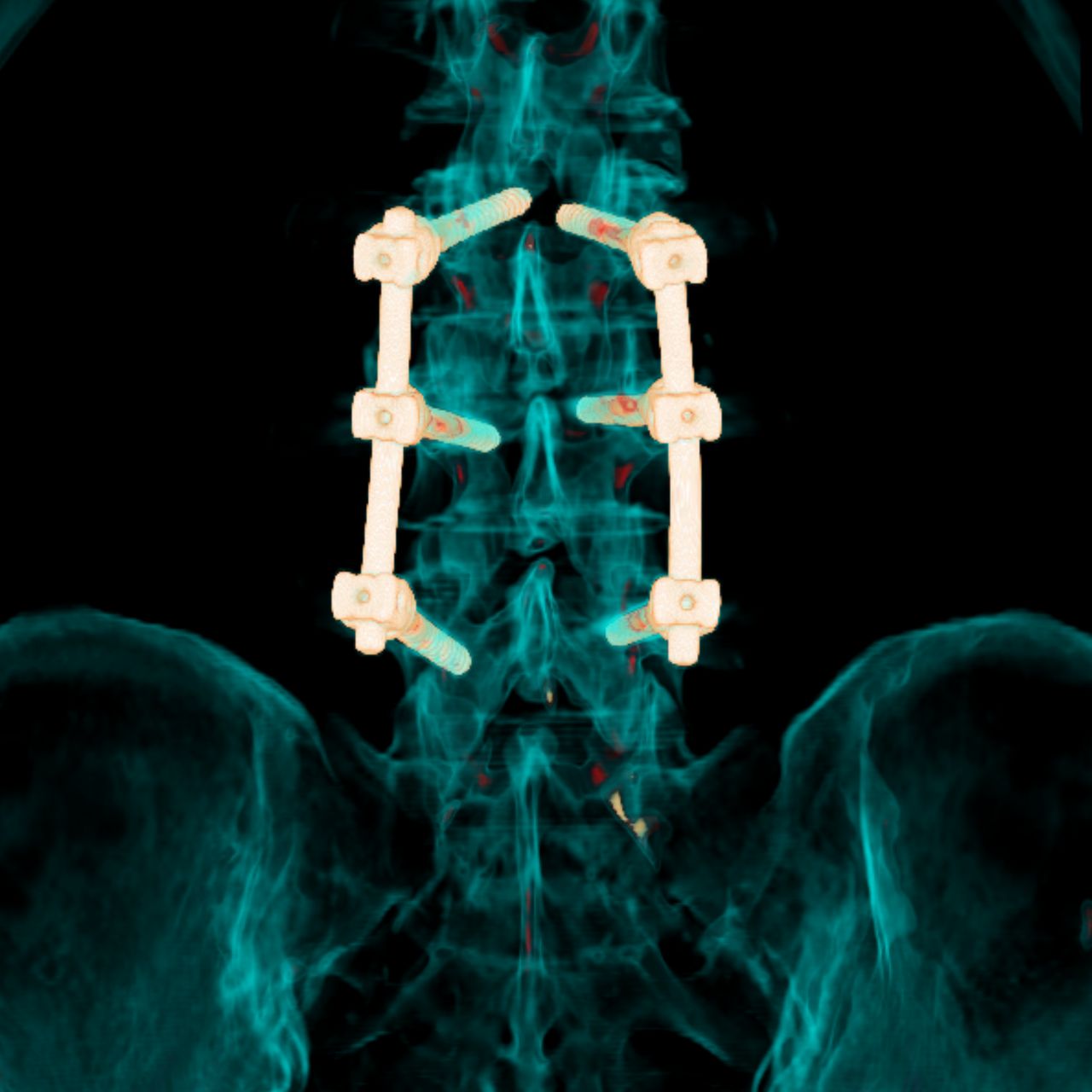 David Tafur Muñoz-1550